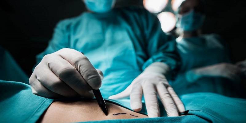 What are Stages of Surgical Procedures?
