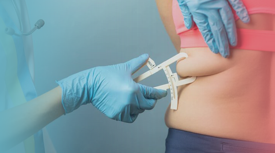 Points to Consider before Going for Liposuction Surgery